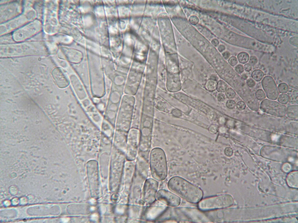 A close-up microscopic view showing multiple ear mites among dark brown ear debris and wax, with detailed mite anatomy visible